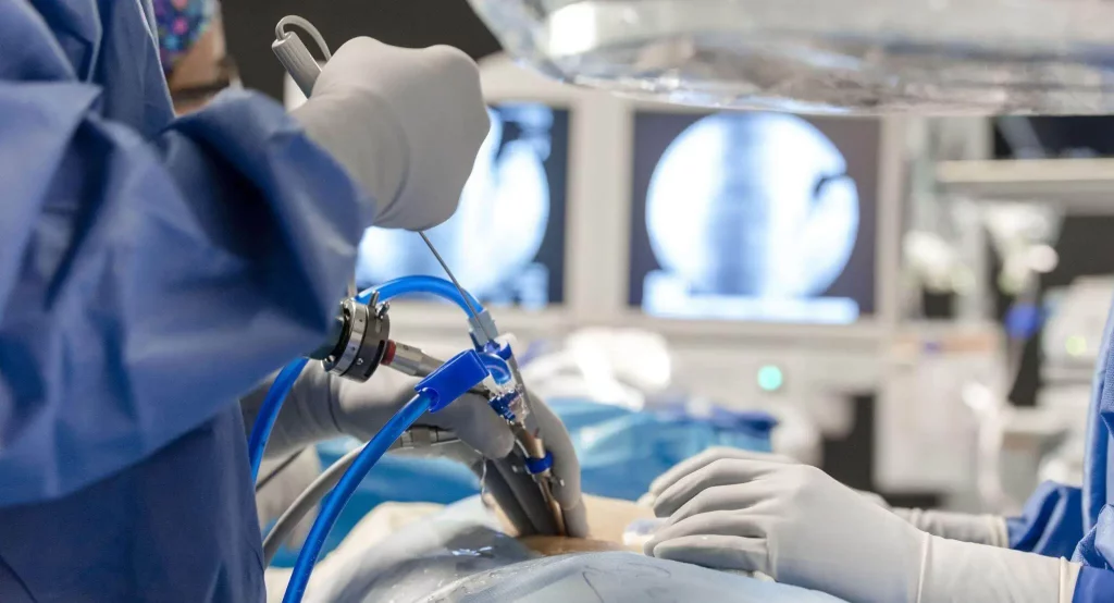 Primer plano de cirugía endoscópica de columna con asistencia de imagenología en quirófano especializado