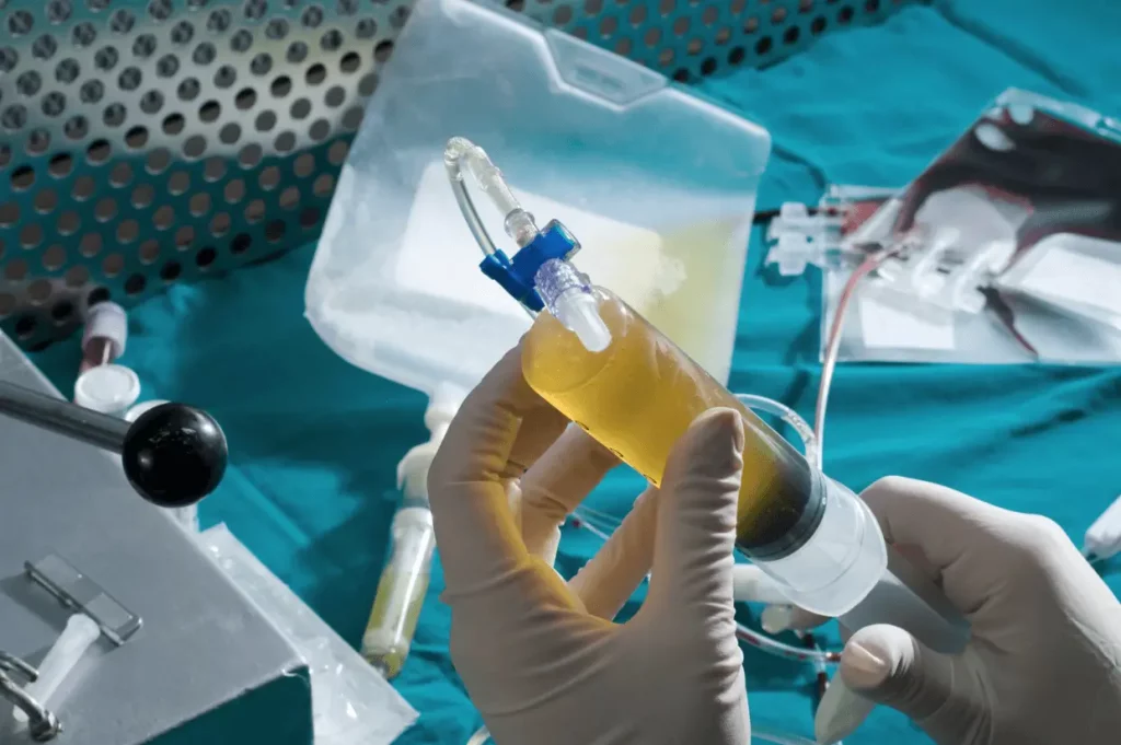 Preparación de medicina regenerativa en laboratorio médico con jeringa y plasma rico en plaquetas