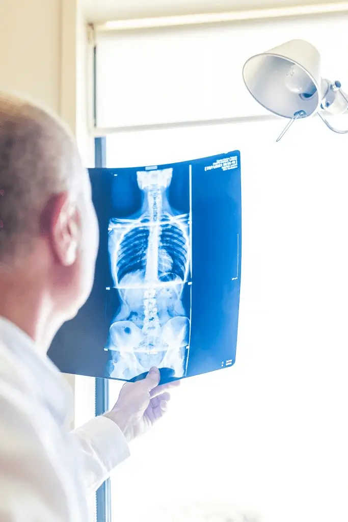 Dr. Gilete revisando radiografía de columna completa frente a la luz